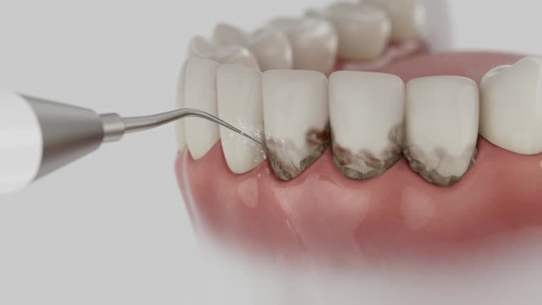 Reliable Dental Implants contractor in Limon, CO by Smile Center Dentistry